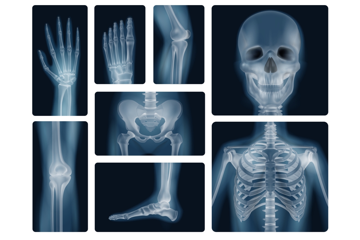 X-Ray Centre in hadapsar