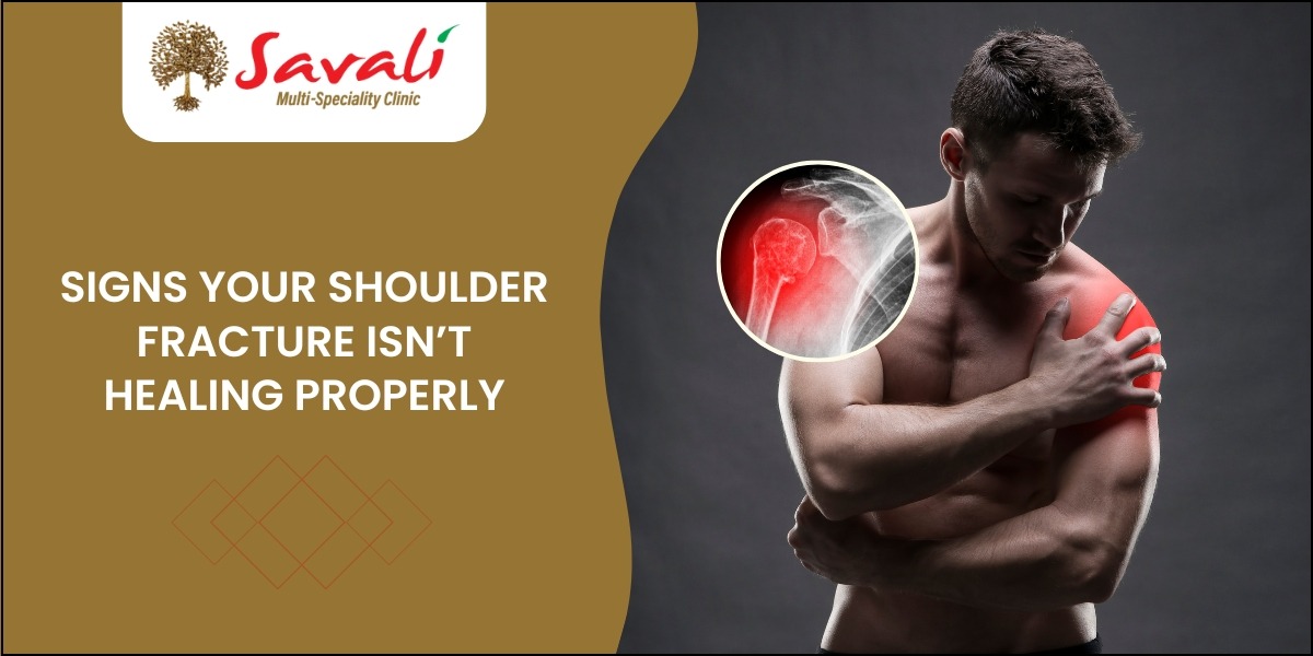 Signs Your Shoulder Fracture Isn’t Healing Properly