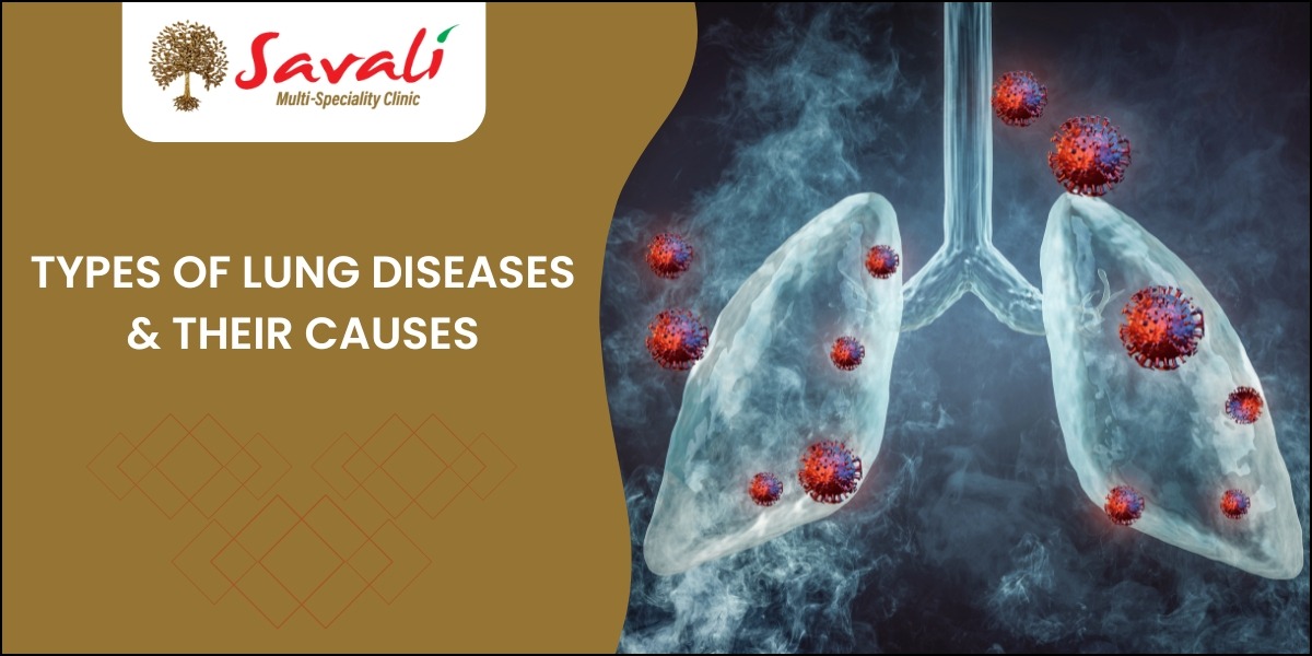 Types of Lung Diseases
